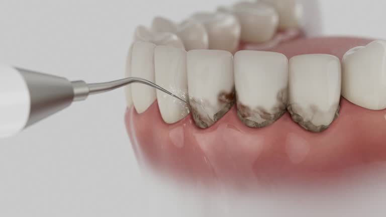 Reliable Dental Implants contractor in Drew, MS by Smile Center Dentistry